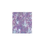 GLITTER 10gr stick